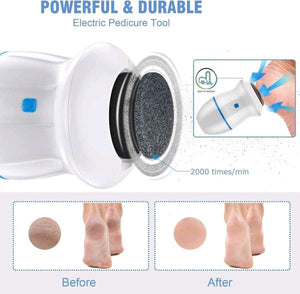 Electric Foot Callus Remover With Built-in Vacuum With Two Modes And Rechargeable